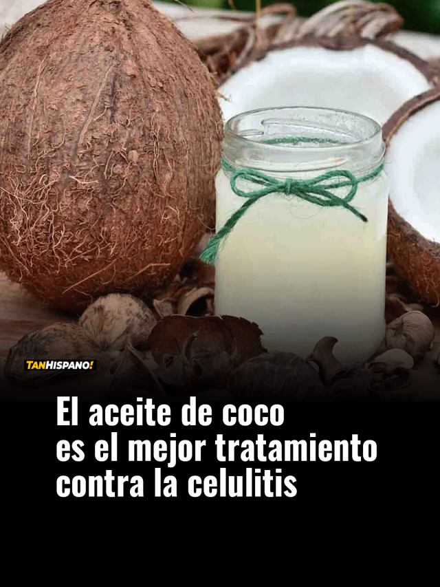 Álbumes 99+ Foto aceite de coco para la celulitis Cena hermosa