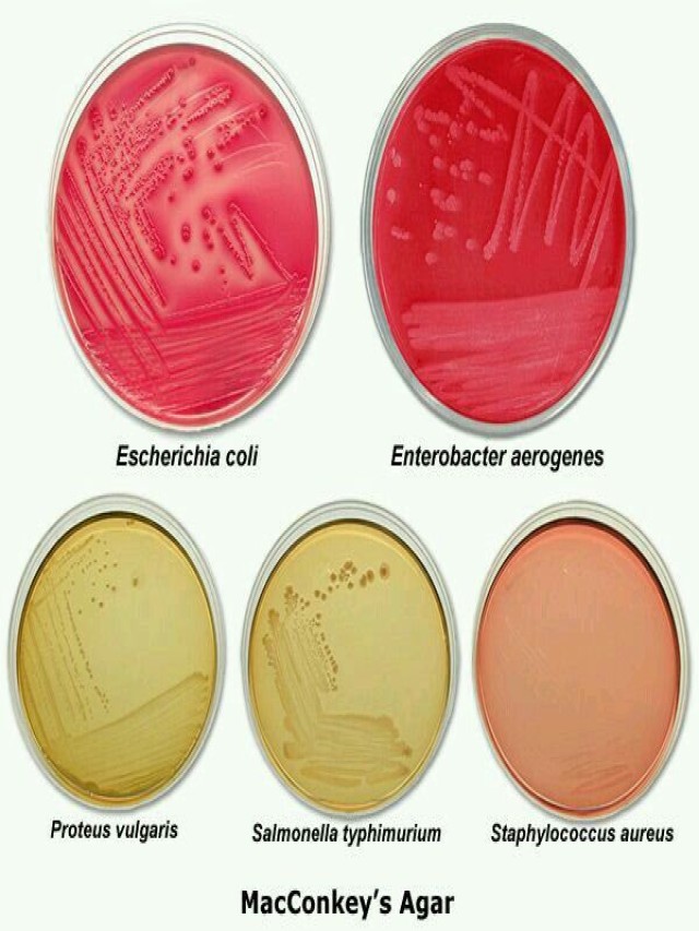 Lista 91+ Foto bacterias que crecen en agar macconkey El último