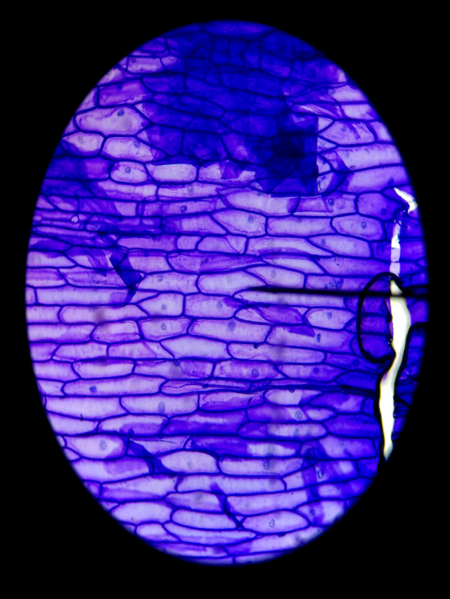 Arriba 101+ Foto celulas de cebolla vistas al microscopio Mirada tensa