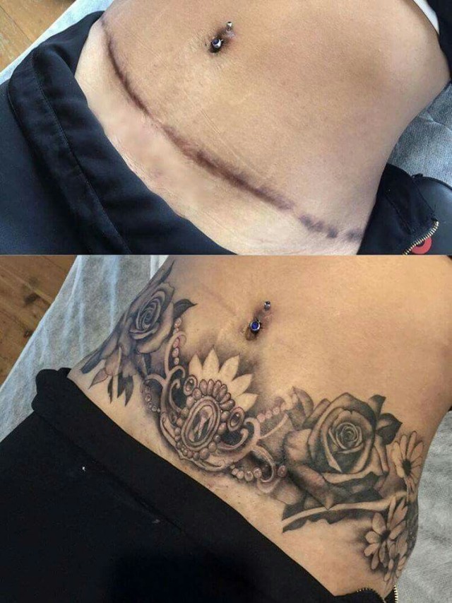 Lista 105+ Foto cesárea tatuajes en el abdomen para tapar cicatrices El último