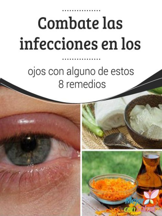 Lista 95+ Foto como desinflamar los ojos cuando tienes tiroides remedios caseros El último