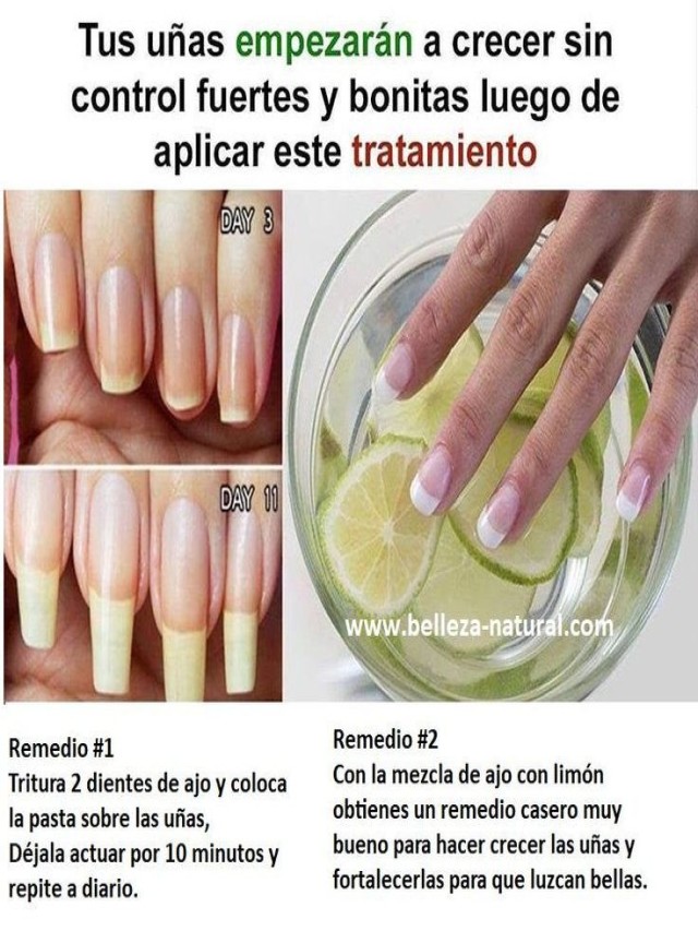 Arriba 104+ Foto como hacer que te crezcan las uñas en 3 días Cena hermosa