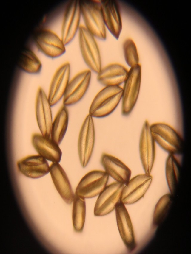 Arriba 99+ Foto como se ve el polen en un microscopio Mirada tensa