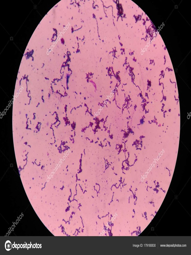 Álbumes 102+ Foto como se ve una bacteria en un microscopio Mirada tensa