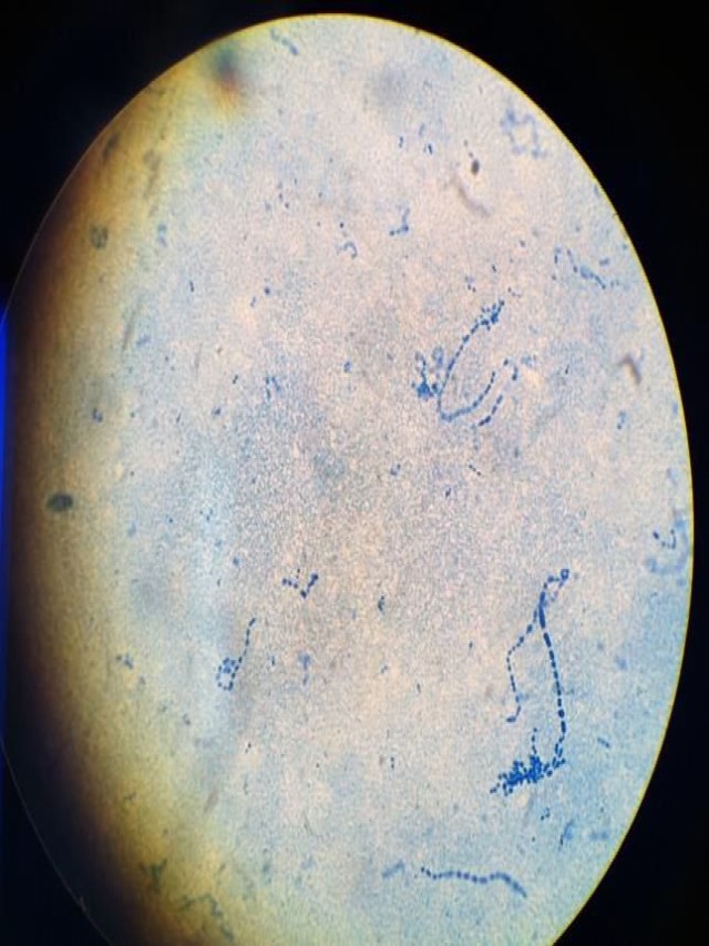 Sintético 97+ Foto como se ven las bacterias en el microscopio Lleno