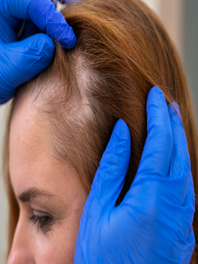 Sintético 105+ Foto cortes de pelo para disimular la calvicie en mujeres Alta definición completa, 2k, 4k