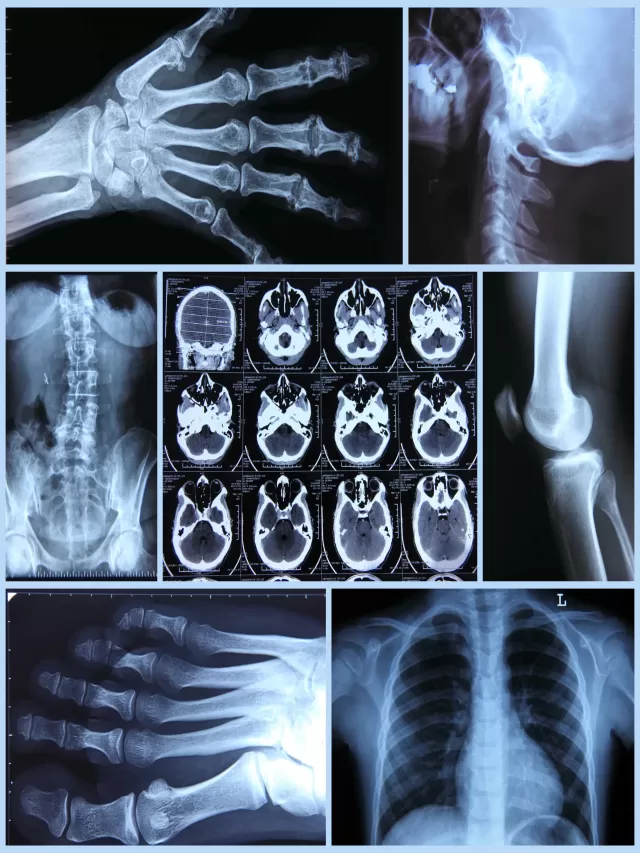 Sintético 93+ Foto cuanto cuesta una radiografia en la/seguridad social Cena hermosa