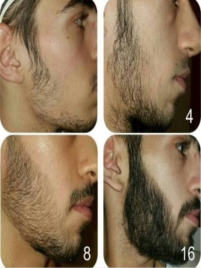 Lista 90+ Foto cuanto tarda en crecer la barba después de afeitarse Lleno
