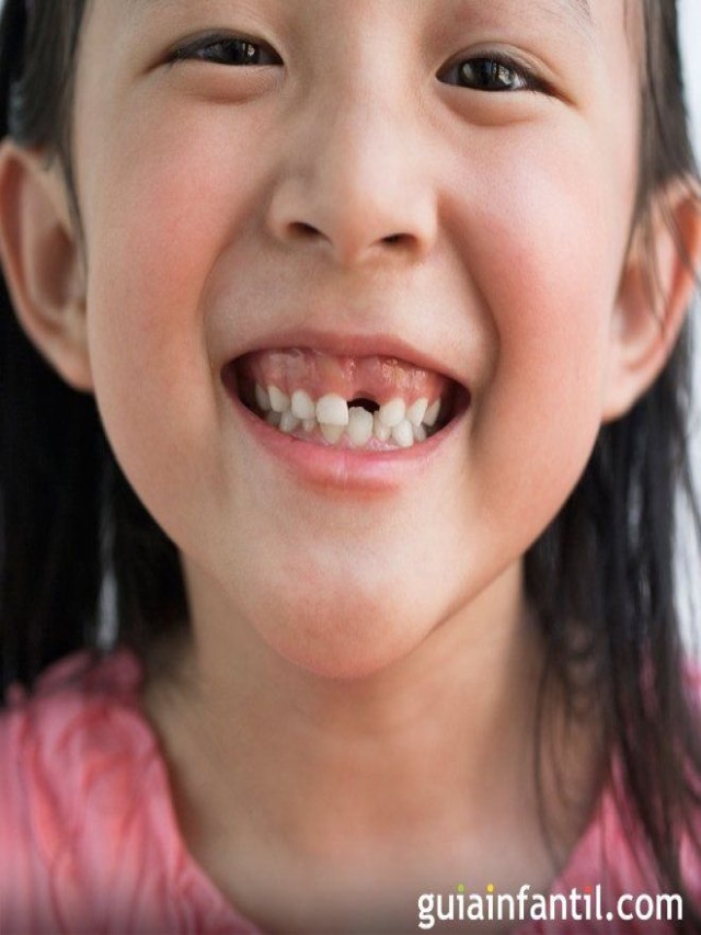 Arriba 102+ Foto dientes picados en bebes de 1 año Mirada tensa
