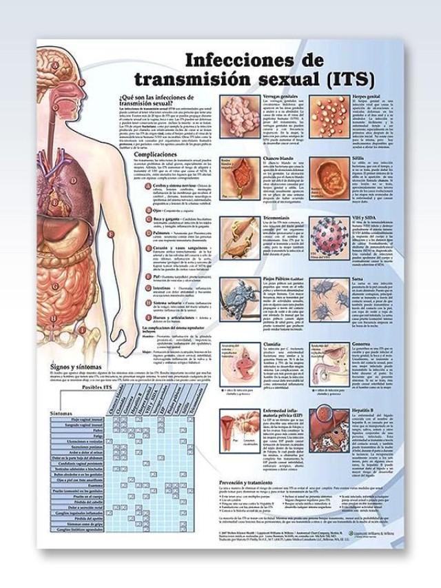 Lista 93+ Foto fotos de infecciones de transmision sexualidad Actualizar
