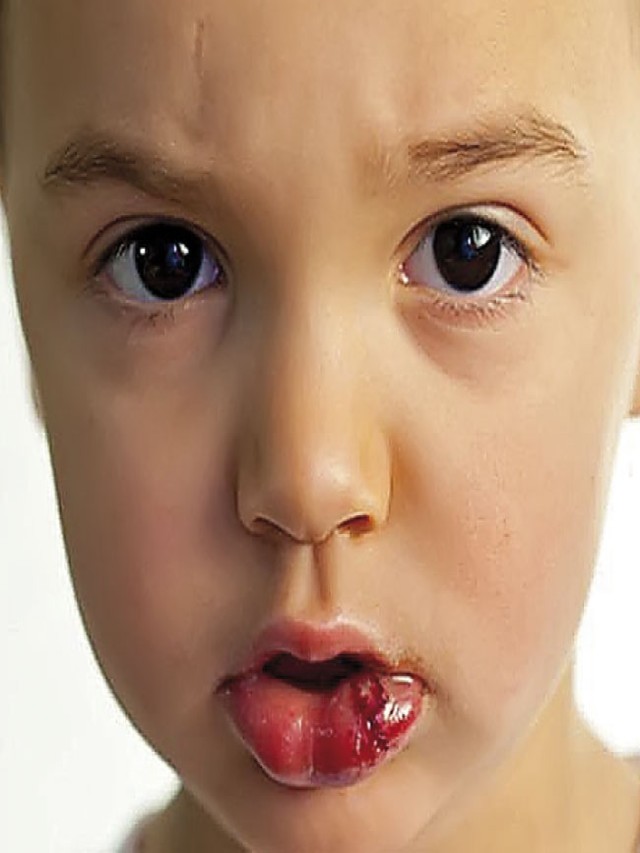 Arriba 103+ Imagen imagenes de dientes podridos en niños Lleno