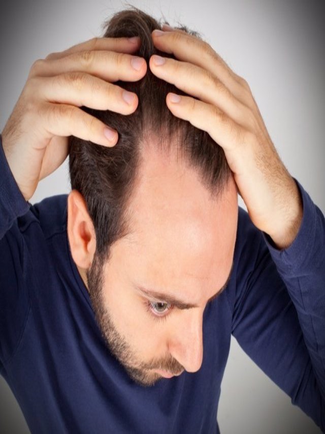 Lista 98+ Foto imágenes de caída de cabello por estrés El último