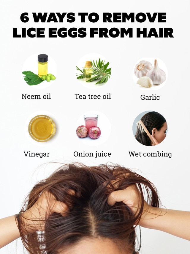 Lista 94+ Imagen indian home remedies for lice egg removal Mirada tensa
