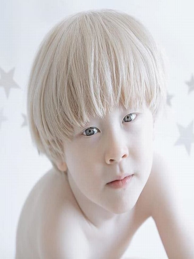 Arriba 92+ Foto los albinos se pueden pintar el pelo Cena hermosa
