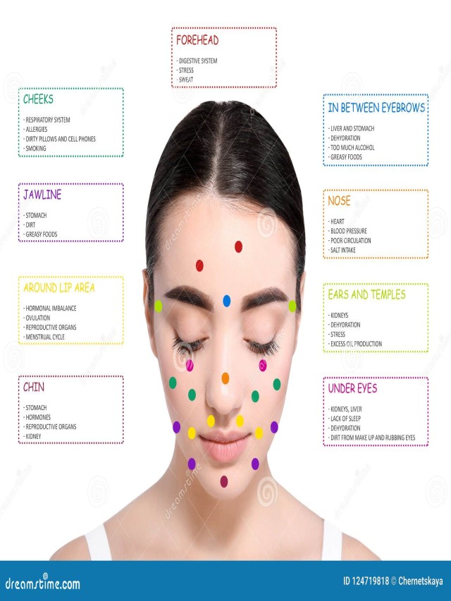 Arriba 94+ Foto mapa del acne en la cara Alta definición completa, 2k, 4k