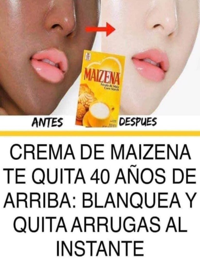 Álbumes 100+ Foto mascarilla de maizena y leche para las manchas Lleno