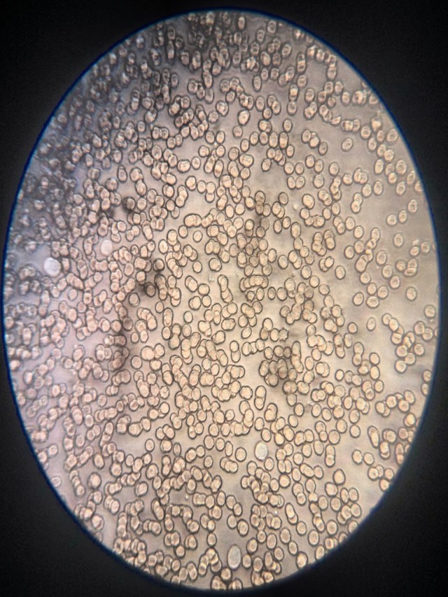 Lista 96+ Foto observacion de sangre en el microscopio Lleno