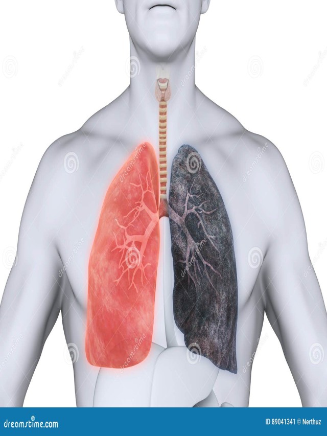 Álbumes 91+ Foto pulmon sano y pulmon de un fumador Actualizar
