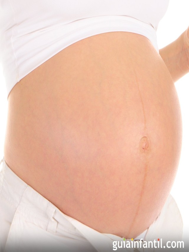 Lista 90+ Foto que significa una raya borrosa en la prueba de embarazo Mirada tensa
