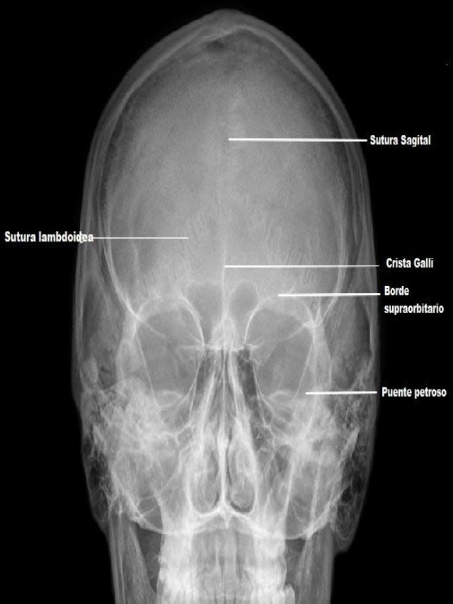 Álbumes 99+ Foto radiografía del cerebro como se llama Mirada tensa