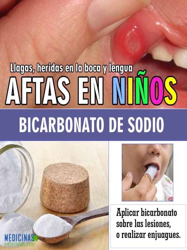 Sintético 91+ Foto remedios caseros para los abscesos en las encías Cena hermosa