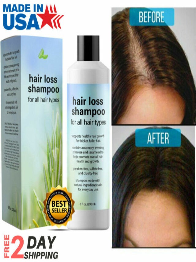Arriba 90+ Foto shampoo natural para la caida del cabello en mujeres Actualizar