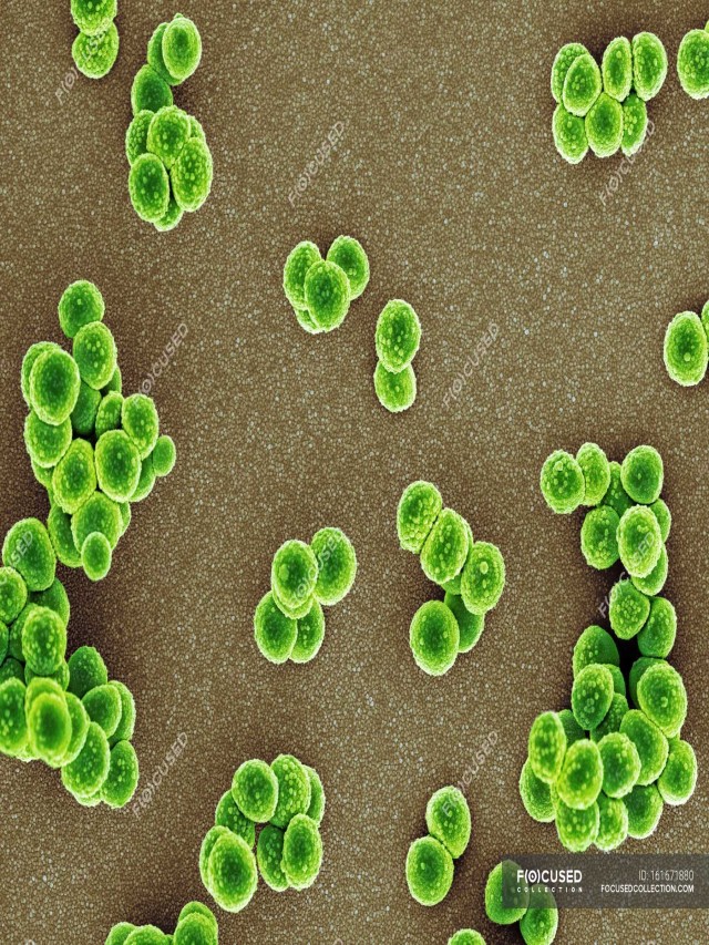 Sintético 100+ Foto staphylococcus aureus resistente a la meticilina El último