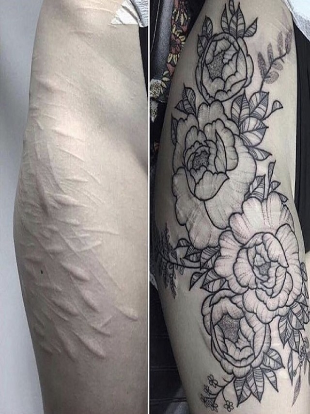 Lista 101+ Imagen tatuajes para tapar cicatrices en el brazo para mujer Mirada tensa