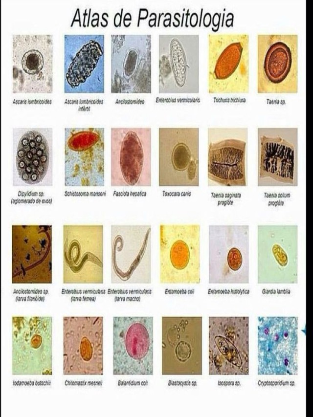 Álbumes 101+ Foto tipos de parásitos intestinales en humanos fotos Mirada tensa