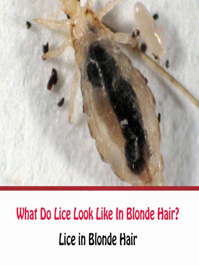 Em geral 90+ Imagen what do lice look like in blonde hair Alta definición completa, 2k, 4k